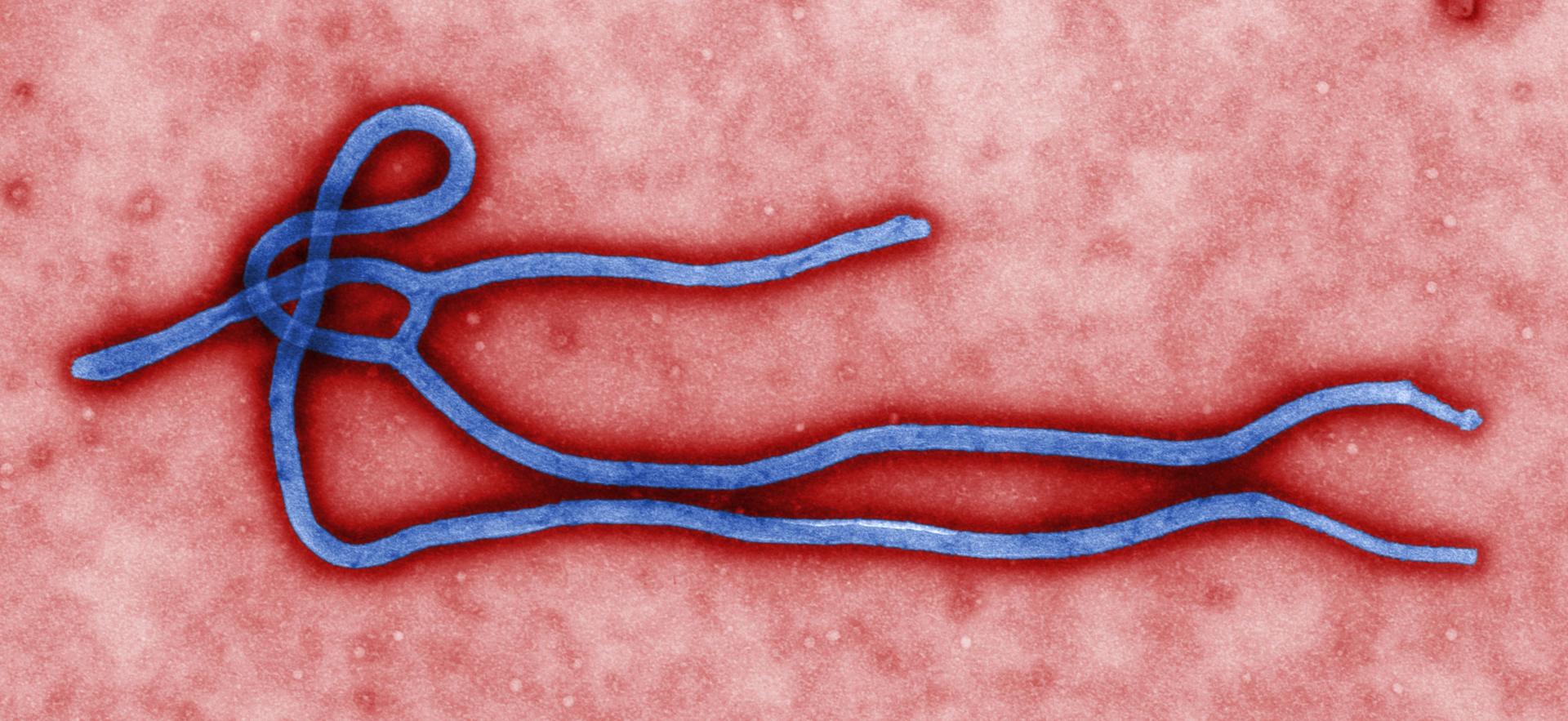 Coloured transmission electron micrograph of an Ebola virus particle, the pathogen behind the East African outbreak.