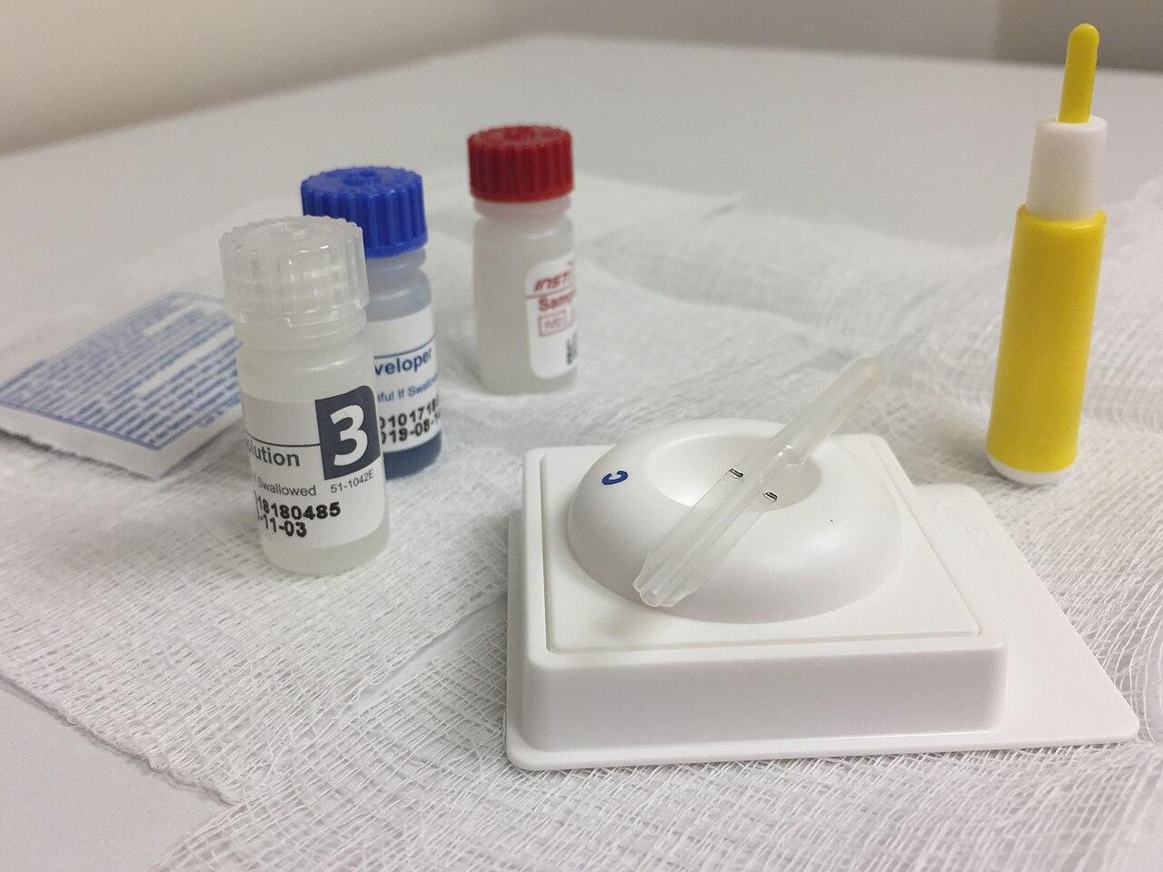 A rapid HIV antibody testing kit with cassette and reagents laid out for use